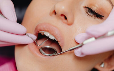 The Importance of Regular Dental Checkups